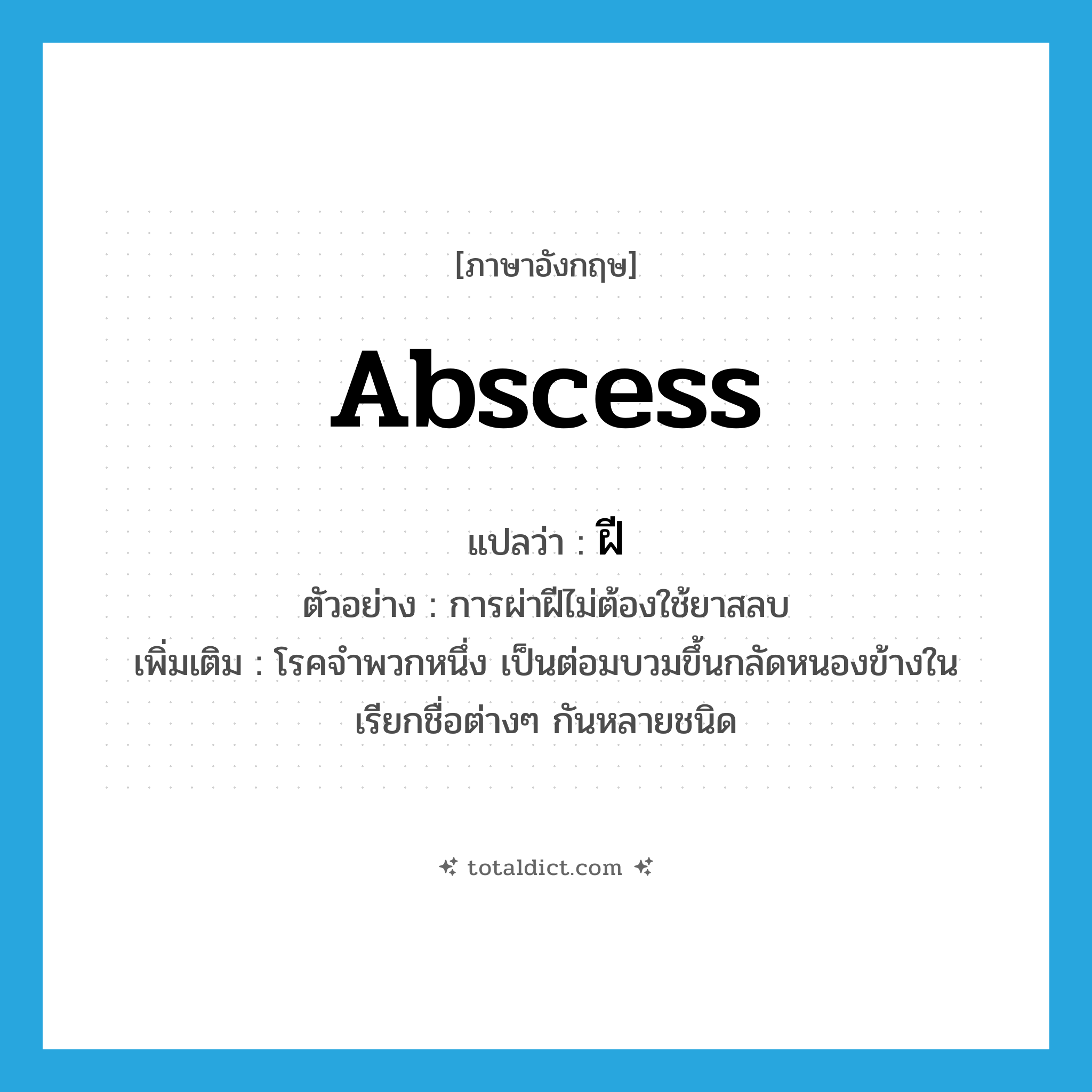 abscess แปลว่า?, คำศัพท์ภาษาอังกฤษ abscess แปลว่า ฝี ประเภท N ตัวอย่าง การผ่าฝีไม่ต้องใช้ยาสลบ เพิ่มเติม โรคจำพวกหนึ่ง เป็นต่อมบวมขึ้นกลัดหนองข้างใน เรียกชื่อต่างๆ กันหลายชนิด หมวด N