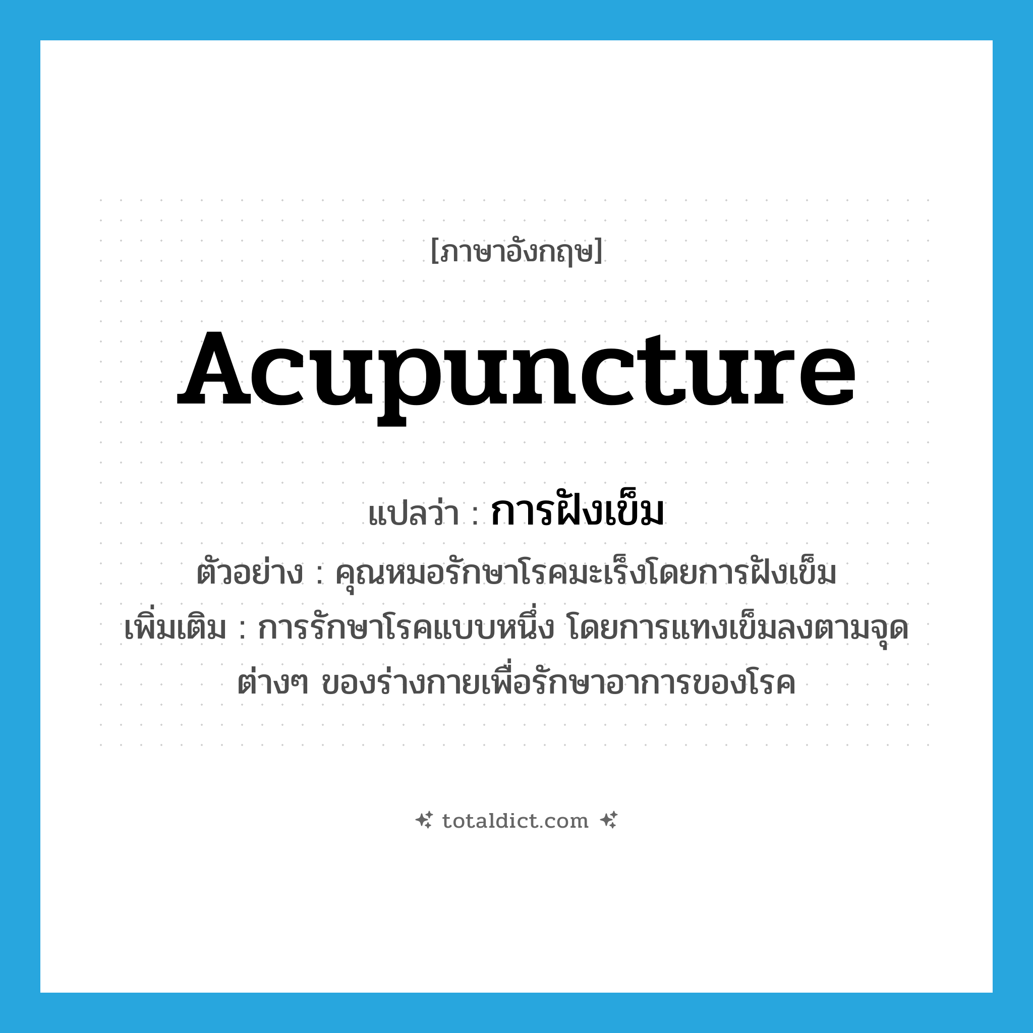 acupuncture แปลว่า?, คำศัพท์ภาษาอังกฤษ acupuncture แปลว่า การฝังเข็ม ประเภท N ตัวอย่าง คุณหมอรักษาโรคมะเร็งโดยการฝังเข็ม เพิ่มเติม การรักษาโรคแบบหนึ่ง โดยการแทงเข็มลงตามจุดต่างๆ ของร่างกายเพื่อรักษาอาการของโรค หมวด N