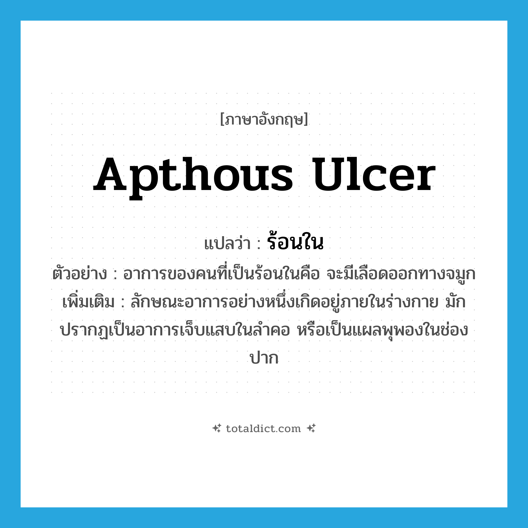 apthous ulcer แปลว่า?, คำศัพท์ภาษาอังกฤษ apthous ulcer แปลว่า ร้อนใน ประเภท N ตัวอย่าง อาการของคนที่เป็นร้อนในคือ จะมีเลือดออกทางจมูก เพิ่มเติม ลักษณะอาการอย่างหนึ่งเกิดอยู่ภายในร่างกาย มักปรากฏเป็นอาการเจ็บแสบในลำคอ หรือเป็นแผลพุพองในช่องปาก หมวด N