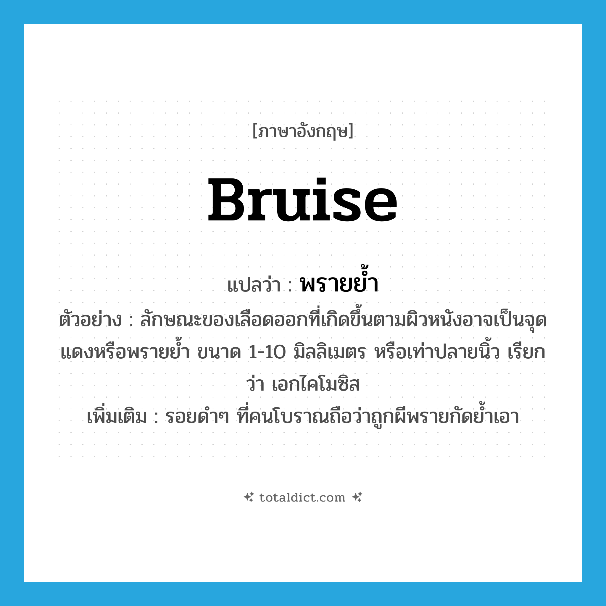 bruise แปลว่า?, คำศัพท์ภาษาอังกฤษ bruise แปลว่า พรายย้ำ ประเภท N ตัวอย่าง ลักษณะของเลือดออกที่เกิดขึ้นตามผิวหนังอาจเป็นจุดแดงหรือพรายย้ำ ขนาด 1-10 มิลลิเมตร หรือเท่าปลายนิ้ว เรียกว่า เอกไคโมซิส เพิ่มเติม รอยดำๆ ที่คนโบราณถือว่าถูกผีพรายกัดย้ำเอา หมวด N