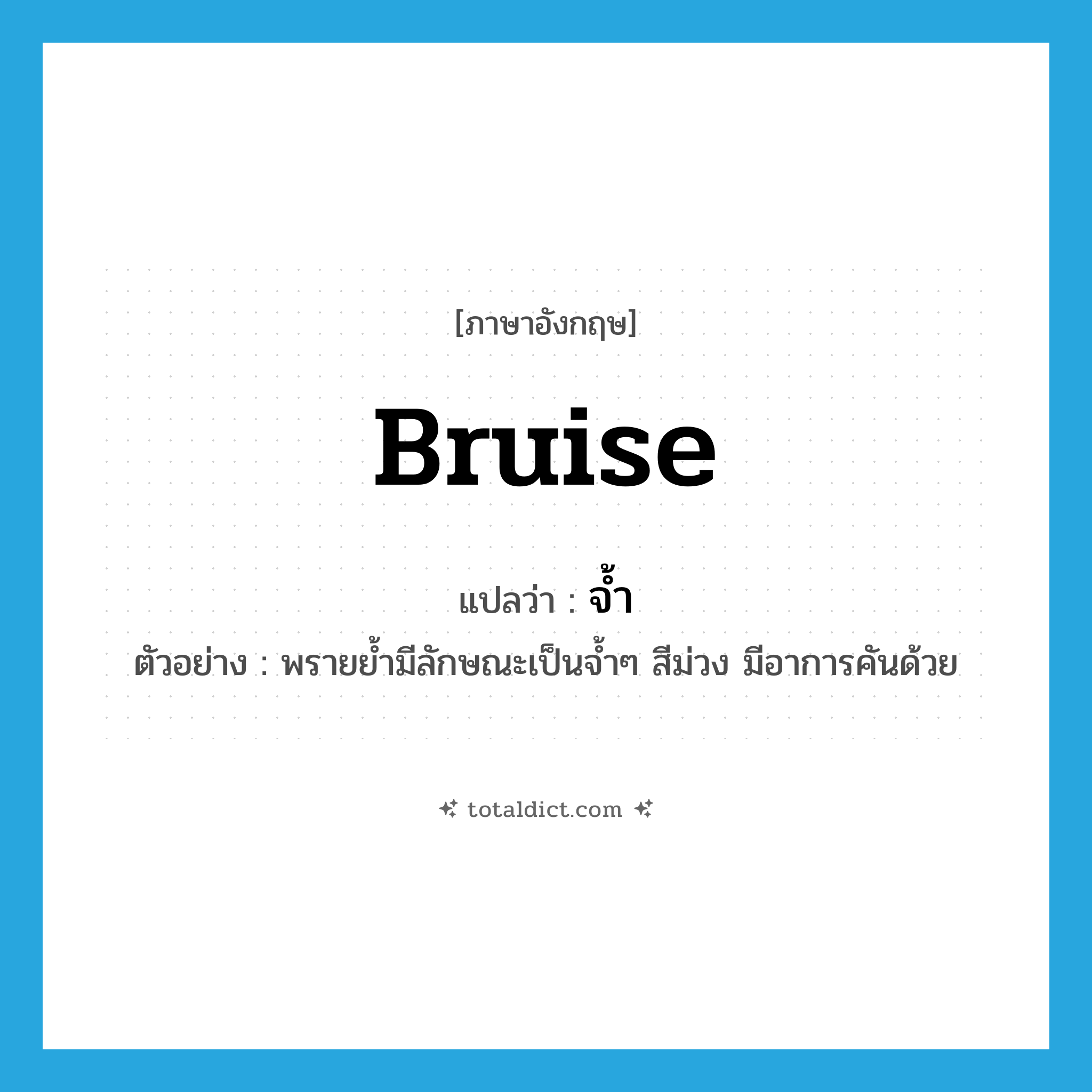 bruise แปลว่า?, คำศัพท์ภาษาอังกฤษ bruise แปลว่า จ้ำ ประเภท N ตัวอย่าง พรายย้ำมีลักษณะเป็นจ้ำๆ สีม่วง มีอาการคันด้วย หมวด N