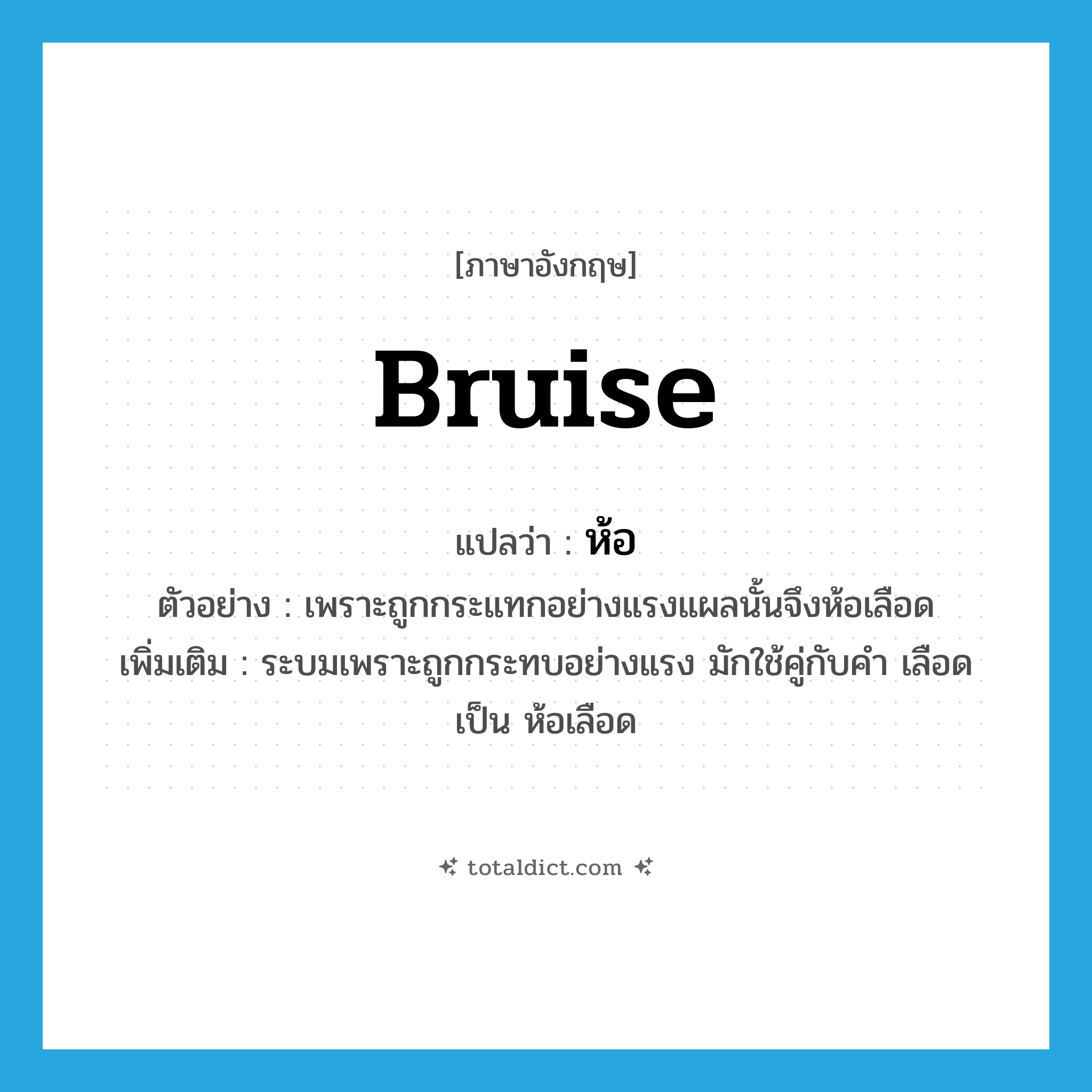 bruise แปลว่า?, คำศัพท์ภาษาอังกฤษ bruise แปลว่า ห้อ ประเภท V ตัวอย่าง เพราะถูกกระแทกอย่างแรงแผลนั้นจึงห้อเลือด เพิ่มเติม ระบมเพราะถูกกระทบอย่างแรง มักใช้คู่กับคำ เลือด เป็น ห้อเลือด หมวด V