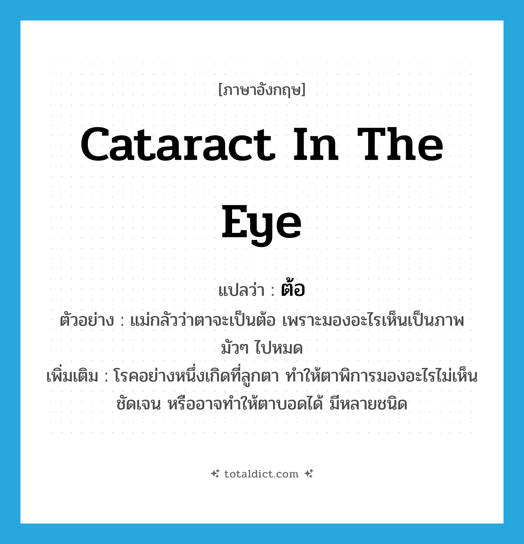 cataract in the eye แปลว่า?, คำศัพท์ภาษาอังกฤษ cataract in the eye แปลว่า ต้อ ประเภท N ตัวอย่าง แม่กลัวว่าตาจะเป็นต้อ เพราะมองอะไรเห็นเป็นภาพมัวๆ ไปหมด เพิ่มเติม โรคอย่างหนึ่งเกิดที่ลูกตา ทำให้ตาพิการมองอะไรไม่เห็นชัดเจน หรืออาจทำให้ตาบอดได้ มีหลายชนิด หมวด N