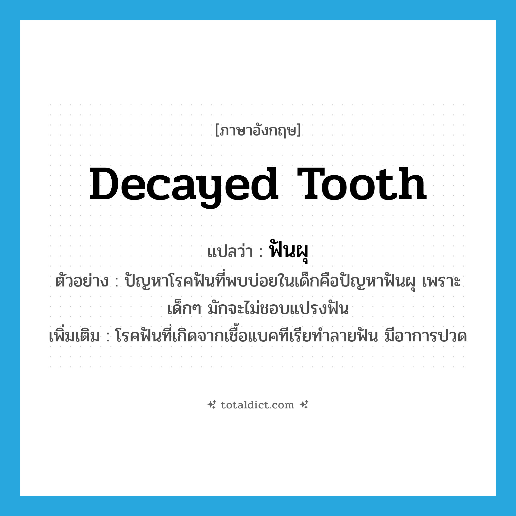 decayed tooth แปลว่า?, คำศัพท์ภาษาอังกฤษ decayed tooth แปลว่า ฟันผุ ประเภท N ตัวอย่าง ปัญหาโรคฟันที่พบบ่อยในเด็กคือปัญหาฟันผุ เพราะเด็กๆ มักจะไม่ชอบแปรงฟัน เพิ่มเติม โรคฟันที่เกิดจากเชื้อแบคทีเรียทำลายฟัน มีอาการปวด หมวด N