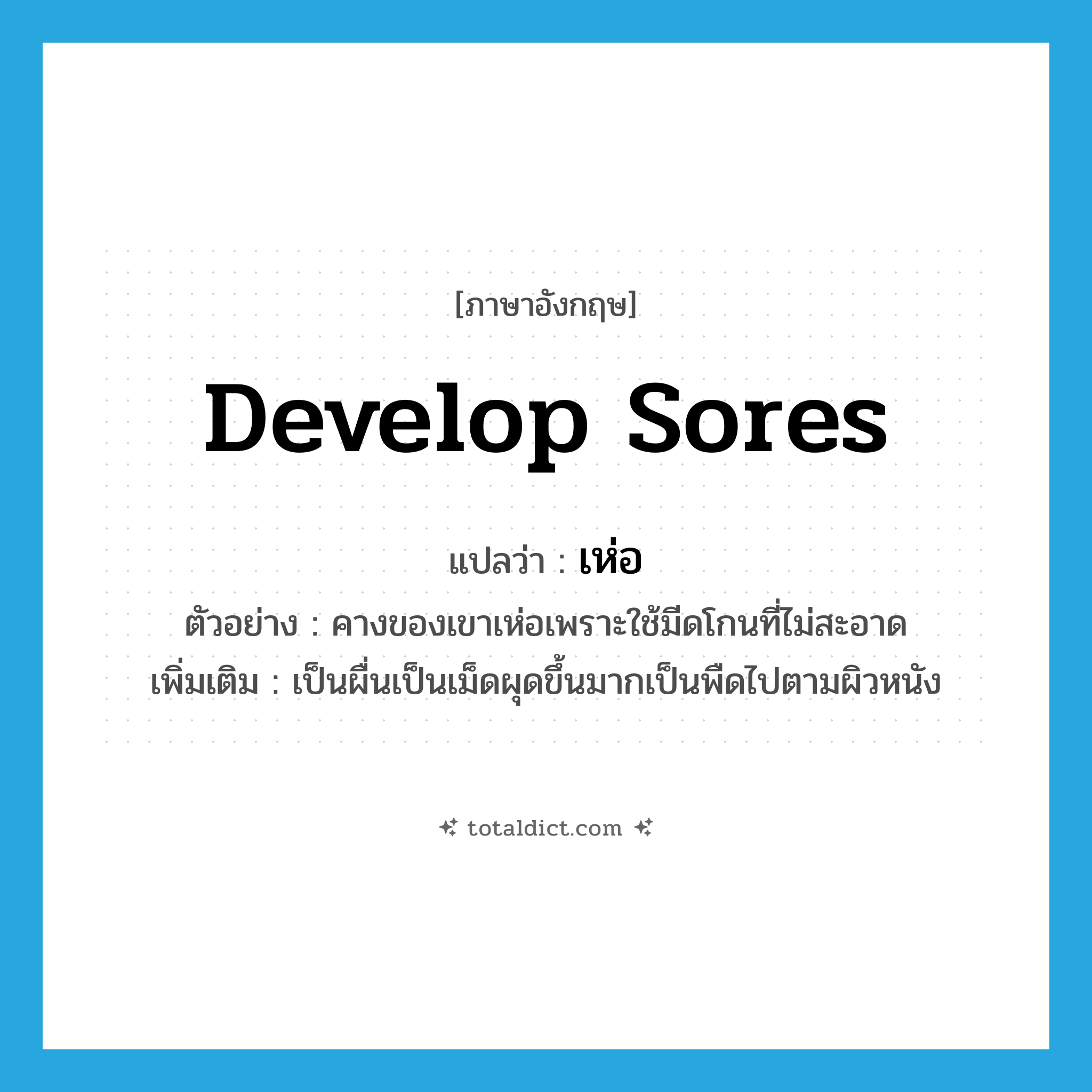 develop sores แปลว่า?, คำศัพท์ภาษาอังกฤษ develop sores แปลว่า เห่อ ประเภท V ตัวอย่าง คางของเขาเห่อเพราะใช้มีดโกนที่ไม่สะอาด เพิ่มเติม เป็นผื่นเป็นเม็ดผุดขึ้นมากเป็นพืดไปตามผิวหนัง หมวด V