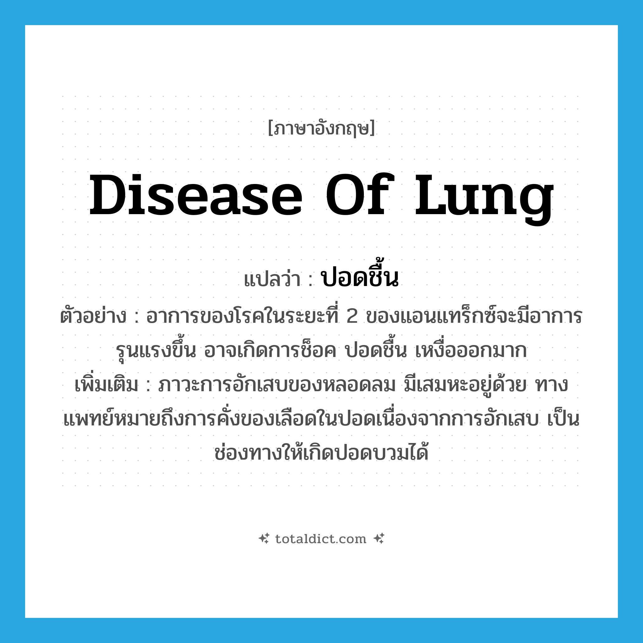 disease of lung แปลว่า?, คำศัพท์ภาษาอังกฤษ disease of lung แปลว่า ปอดชื้น ประเภท N ตัวอย่าง อาการของโรคในระยะที่ 2 ของแอนแทร็กซ์จะมีอาการรุนแรงขึ้น อาจเกิดการช็อค ปอดชื้น เหงื่อออกมาก เพิ่มเติม ภาวะการอักเสบของหลอดลม มีเสมหะอยู่ด้วย ทางแพทย์หมายถึงการคั่งของเลือดในปอดเนื่องจากการอักเสบ เป็นช่องทางให้เกิดปอดบวมได้ หมวด N