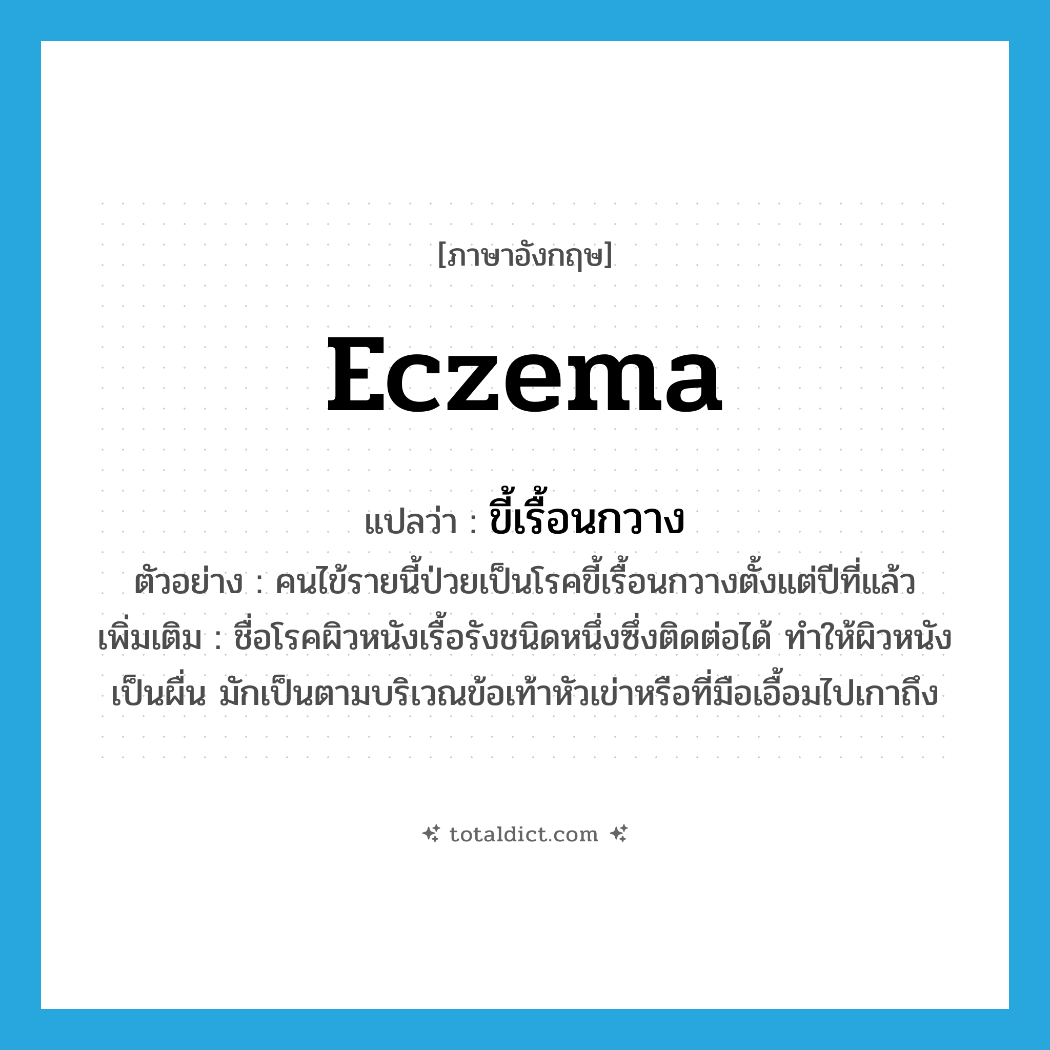 eczema แปลว่า?, คำศัพท์ภาษาอังกฤษ eczema แปลว่า ขี้เรื้อนกวาง ประเภท N ตัวอย่าง คนไข้รายนี้ป่วยเป็นโรคขี้เรื้อนกวางตั้งแต่ปีที่แล้ว เพิ่มเติม ชื่อโรคผิวหนังเรื้อรังชนิดหนึ่งซึ่งติดต่อได้ ทำให้ผิวหนังเป็นผื่น มักเป็นตามบริเวณข้อเท้าหัวเข่าหรือที่มือเอื้อมไปเกาถึง หมวด N