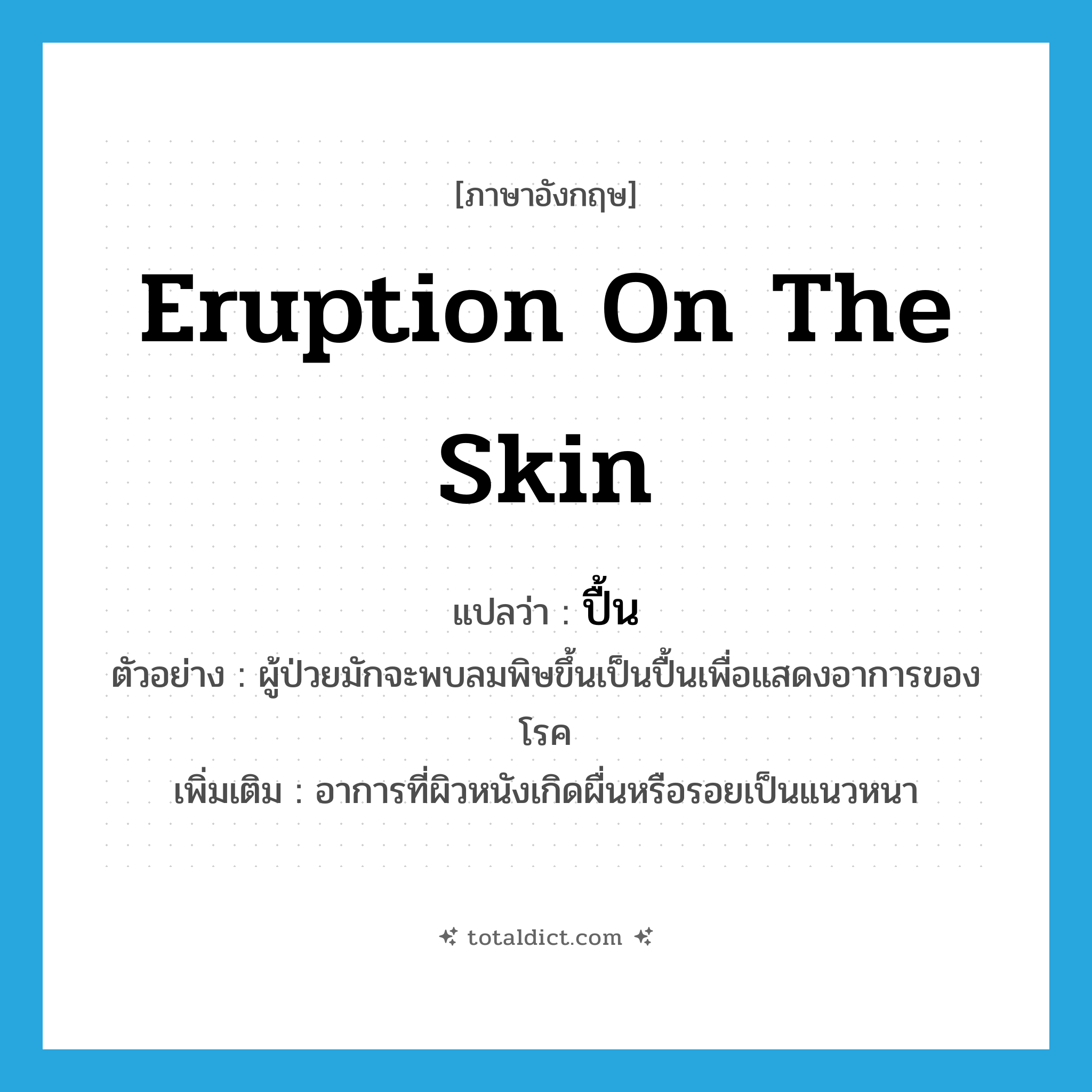 eruption on the skin แปลว่า?, คำศัพท์ภาษาอังกฤษ eruption on the skin แปลว่า ปื้น ประเภท N ตัวอย่าง ผู้ป่วยมักจะพบลมพิษขึ้นเป็นปื้นเพื่อแสดงอาการของโรค เพิ่มเติม อาการที่ผิวหนังเกิดผื่นหรือรอยเป็นแนวหนา หมวด N
