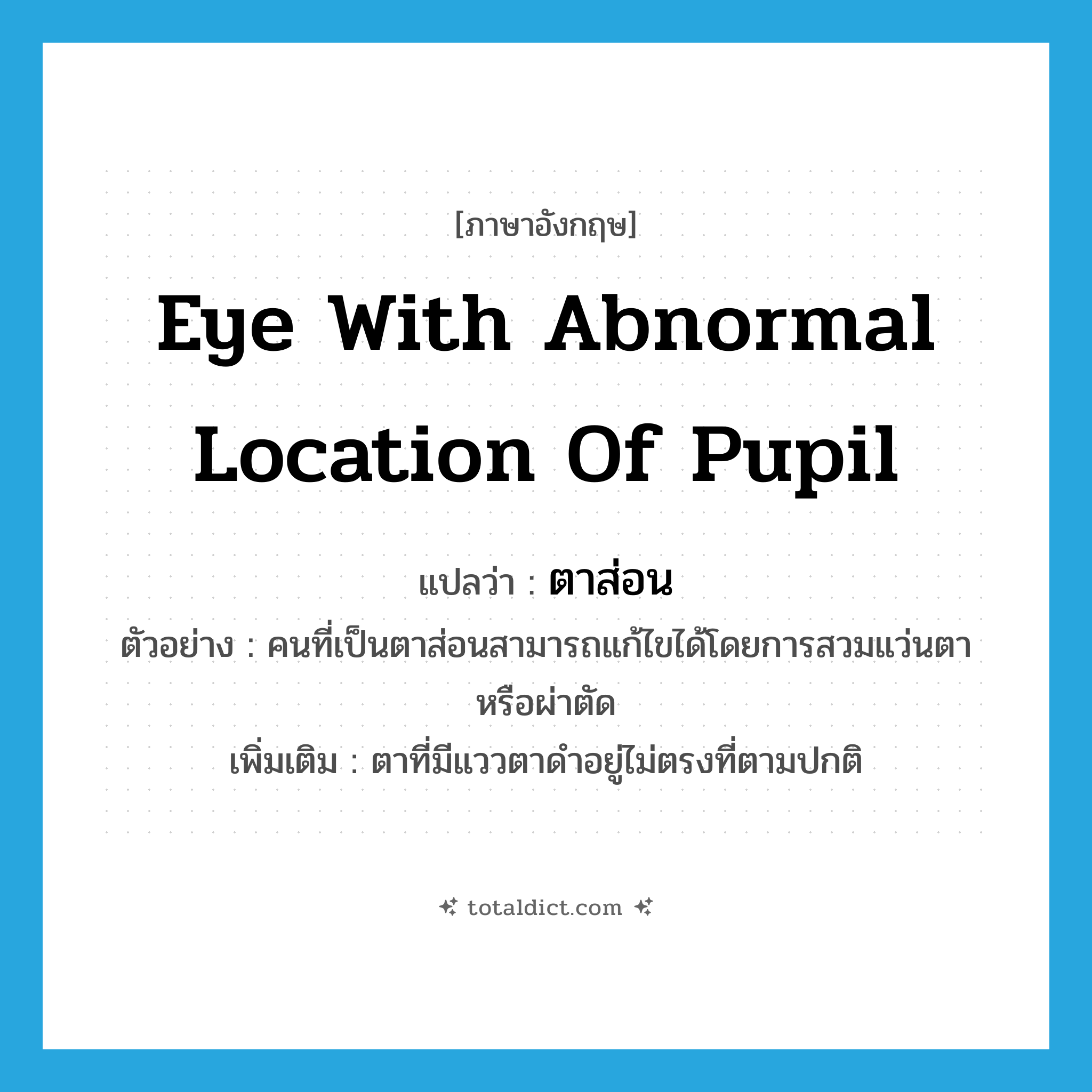 eye with abnormal location of pupil แปลว่า?, คำศัพท์ภาษาอังกฤษ eye with abnormal location of pupil แปลว่า ตาส่อน ประเภท N ตัวอย่าง คนที่เป็นตาส่อนสามารถแก้ไขได้โดยการสวมแว่นตาหรือผ่าตัด เพิ่มเติม ตาที่มีแววตาดำอยู่ไม่ตรงที่ตามปกติ หมวด N