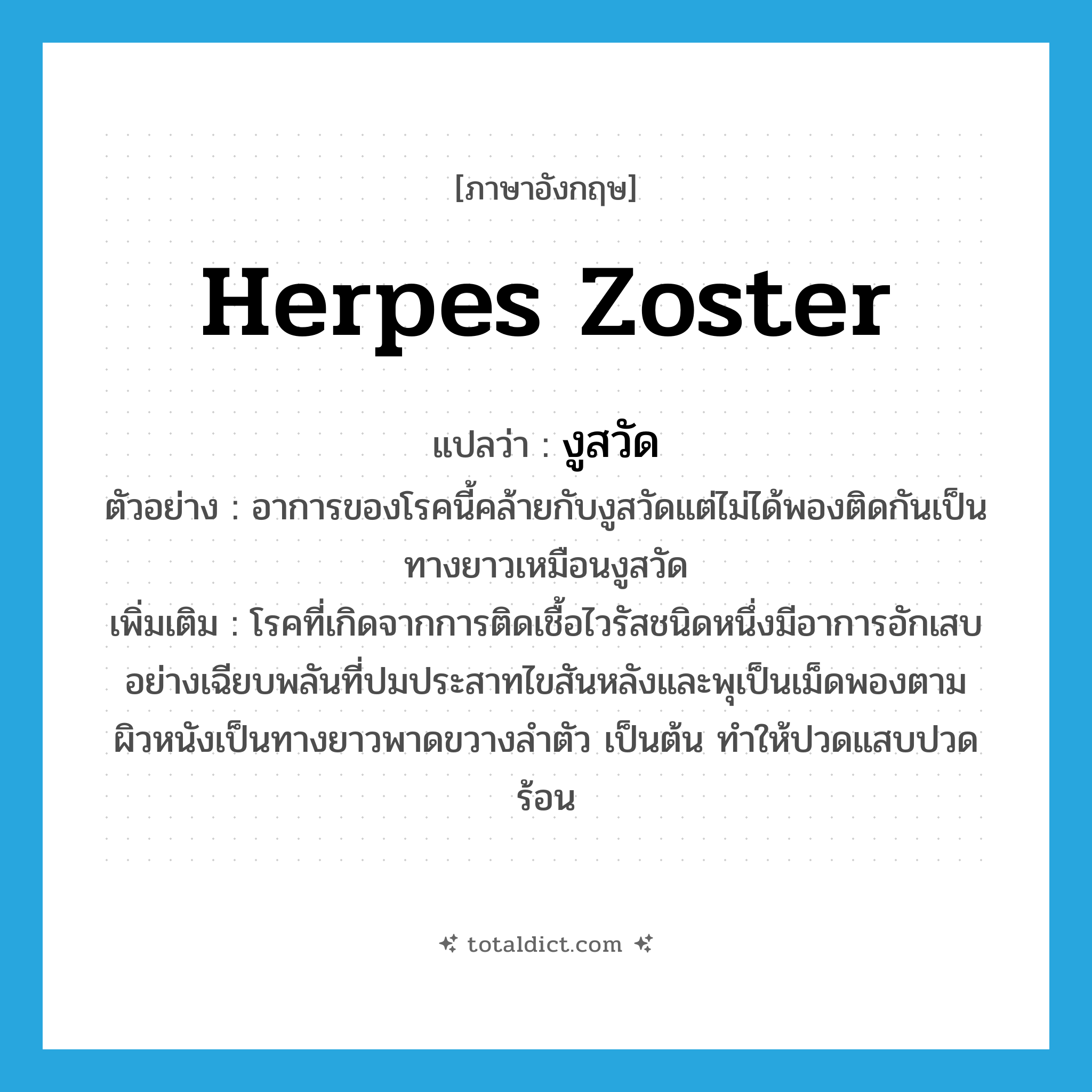 herpes zoster แปลว่า?, คำศัพท์ภาษาอังกฤษ herpes zoster แปลว่า งูสวัด ประเภท N ตัวอย่าง อาการของโรคนี้คล้ายกับงูสวัดแต่ไม่ได้พองติดกันเป็นทางยาวเหมือนงูสวัด เพิ่มเติม โรคที่เกิดจากการติดเชื้อไวรัสชนิดหนึ่งมีอาการอักเสบอย่างเฉียบพลันที่ปมประสาทไขสันหลังและพุเป็นเม็ดพองตามผิวหนังเป็นทางยาวพาดขวางลำตัว เป็นต้น ทำให้ปวดแสบปวดร้อน หมวด N
