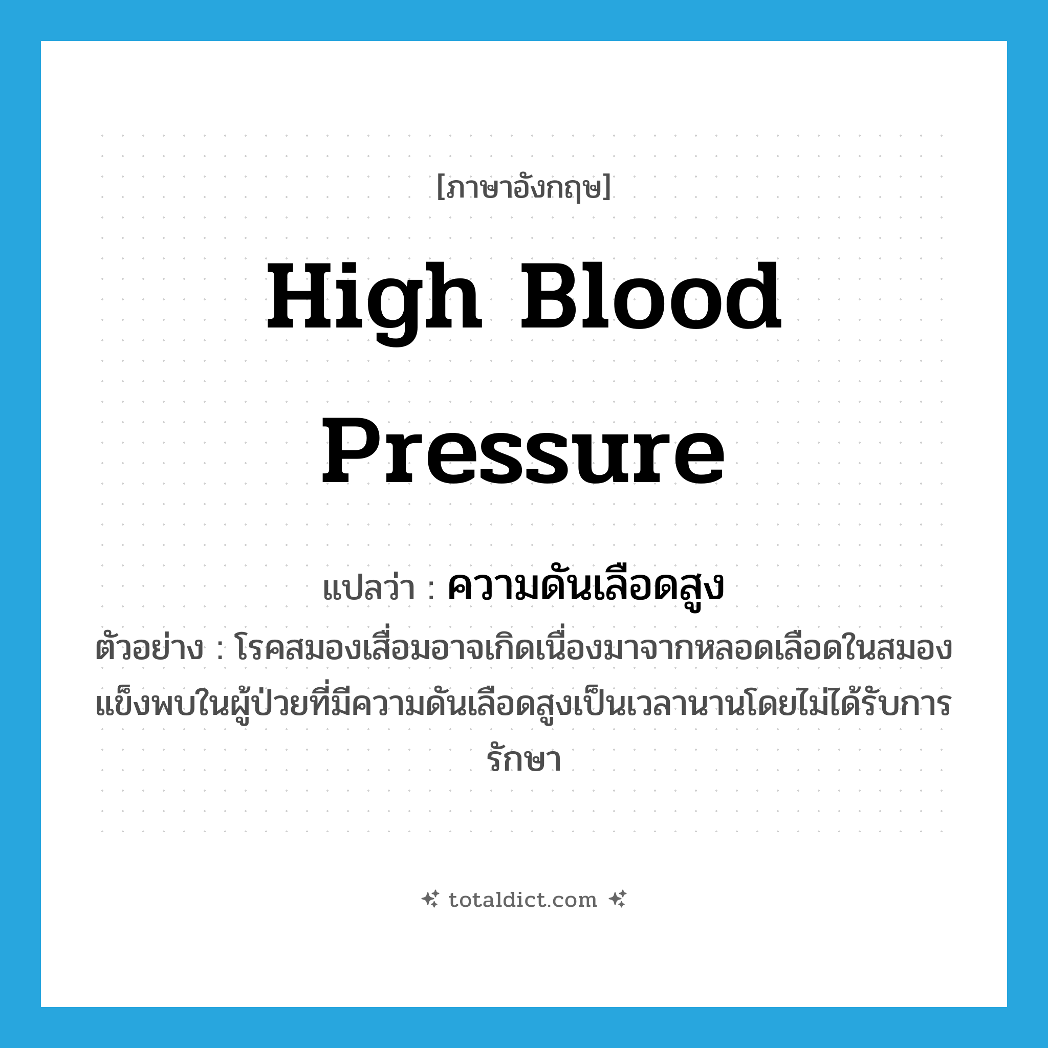high blood pressure แปลว่า?, คำศัพท์ภาษาอังกฤษ high blood pressure แปลว่า ความดันเลือดสูง ประเภท N ตัวอย่าง โรคสมองเสื่อมอาจเกิดเนื่องมาจากหลอดเลือดในสมองแข็งพบในผู้ป่วยที่มีความดันเลือดสูงเป็นเวลานานโดยไม่ได้รับการรักษา หมวด N