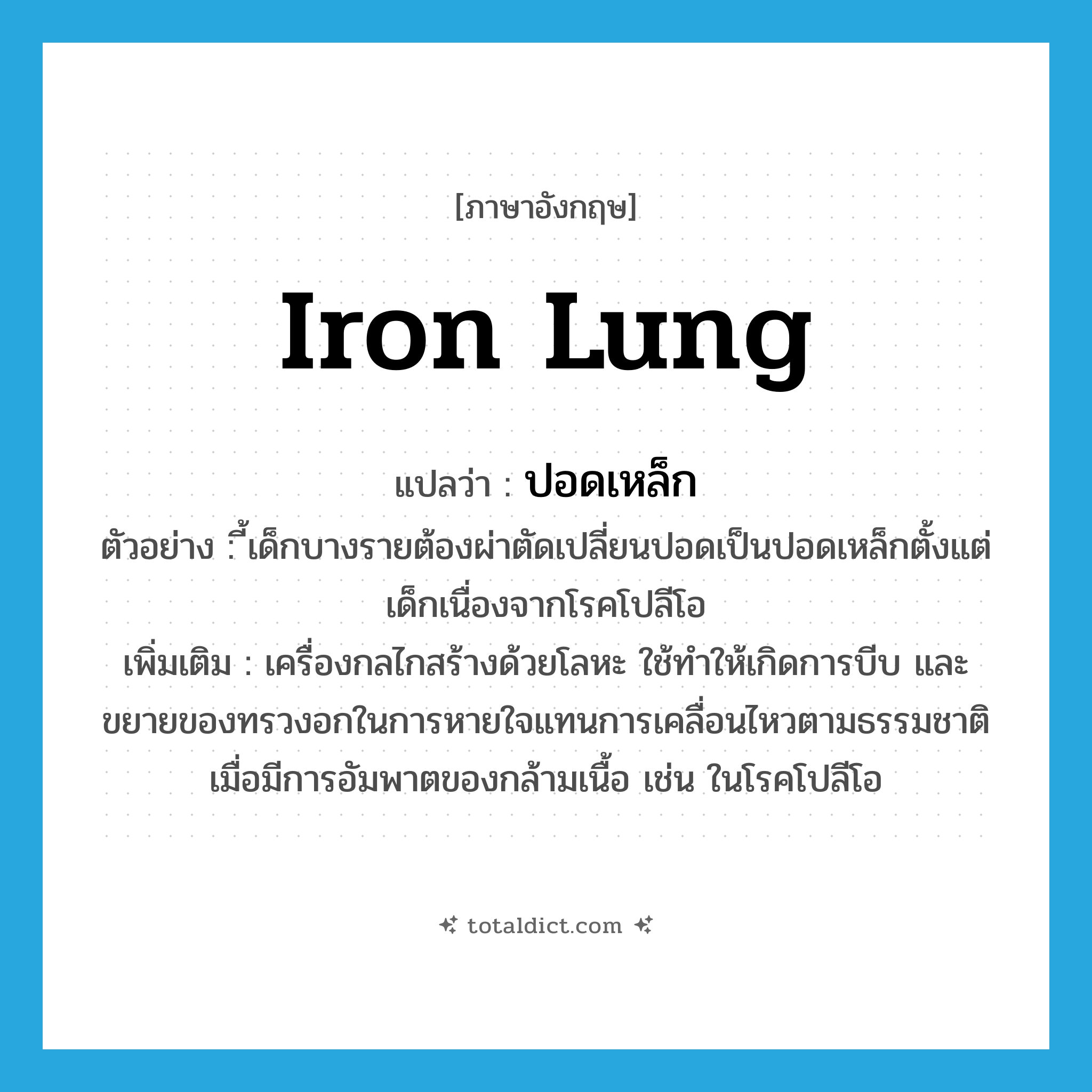iron lung แปลว่า?, คำศัพท์ภาษาอังกฤษ iron lung แปลว่า ปอดเหล็ก ประเภท N ตัวอย่าง ี้เด็กบางรายต้องผ่าตัดเปลี่ยนปอดเป็นปอดเหล็กตั้งแต่เด็กเนื่องจากโรคโปลีโอ เพิ่มเติม เครื่องกลไกสร้างด้วยโลหะ ใช้ทำให้เกิดการบีบ และขยายของทรวงอกในการหายใจแทนการเคลื่อนไหวตามธรรมชาติ เมื่อมีการอัมพาตของกล้ามเนื้อ เช่น ในโรคโปลีโอ หมวด N