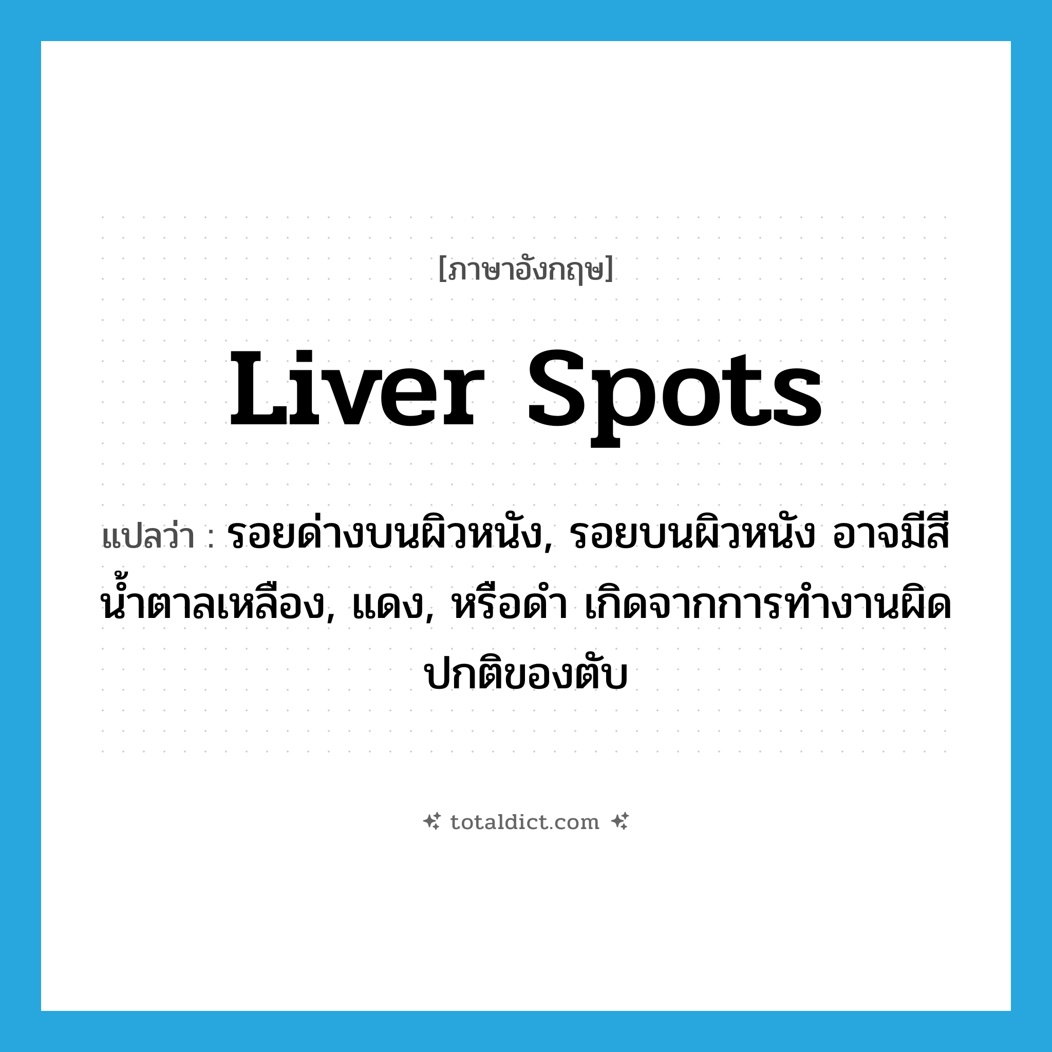 liver spots แปลว่า?, คำศัพท์ภาษาอังกฤษ liver spots แปลว่า รอยด่างบนผิวหนัง, รอยบนผิวหนัง อาจมีสีน้ำตาลเหลือง, แดง, หรือดำ เกิดจากการทำงานผิดปกติของตับ ประเภท N หมวด N