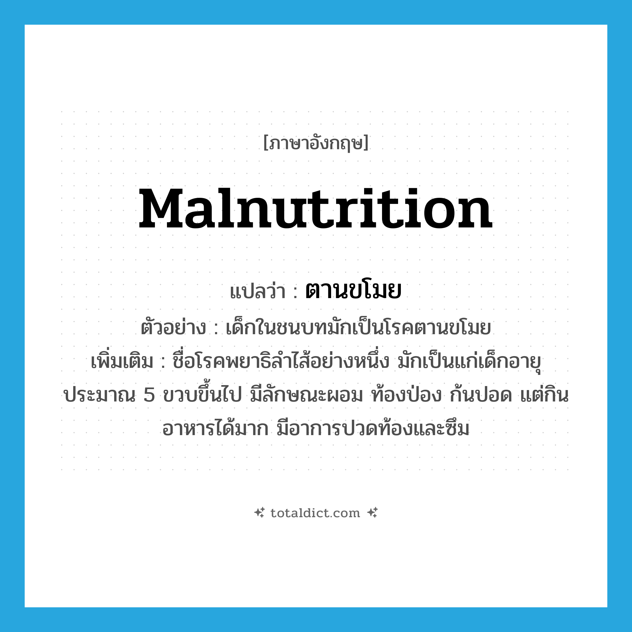 malnutrition แปลว่า?, คำศัพท์ภาษาอังกฤษ malnutrition แปลว่า ตานขโมย ประเภท N ตัวอย่าง เด็กในชนบทมักเป็นโรคตานขโมย เพิ่มเติม ชื่อโรคพยาธิลำไส้อย่างหนึ่ง มักเป็นแก่เด็กอายุประมาณ 5 ขวบขึ้นไป มีลักษณะผอม ท้องป่อง ก้นปอด แต่กินอาหารได้มาก มีอาการปวดท้องและซึม หมวด N
