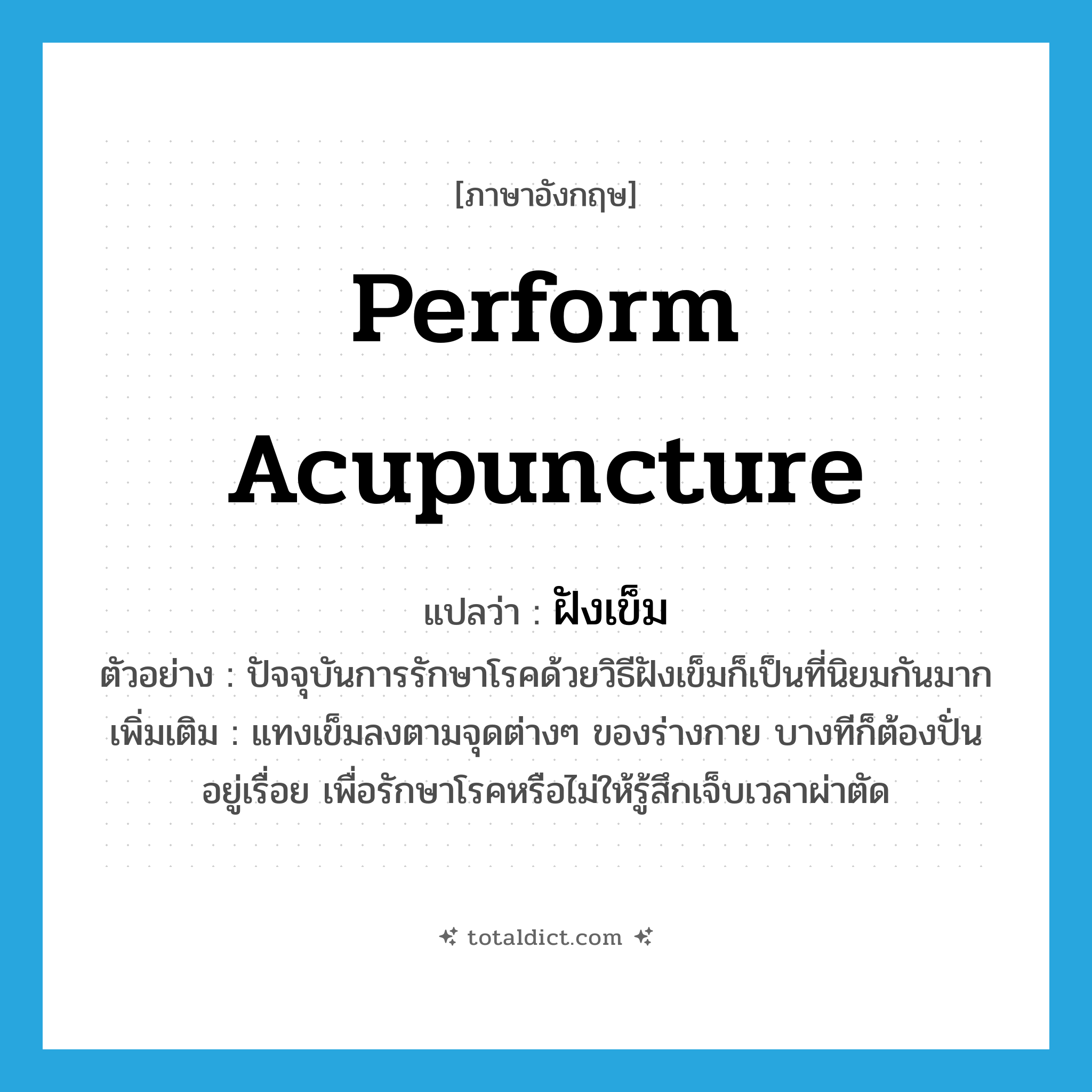 perform acupuncture แปลว่า?, คำศัพท์ภาษาอังกฤษ perform acupuncture แปลว่า ฝังเข็ม ประเภท V ตัวอย่าง ปัจจุบันการรักษาโรคด้วยวิธีฝังเข็มก็เป็นที่นิยมกันมาก เพิ่มเติม แทงเข็มลงตามจุดต่างๆ ของร่างกาย บางทีก็ต้องปั่นอยู่เรื่อย เพื่อรักษาโรคหรือไม่ให้รู้สึกเจ็บเวลาผ่าตัด หมวด V