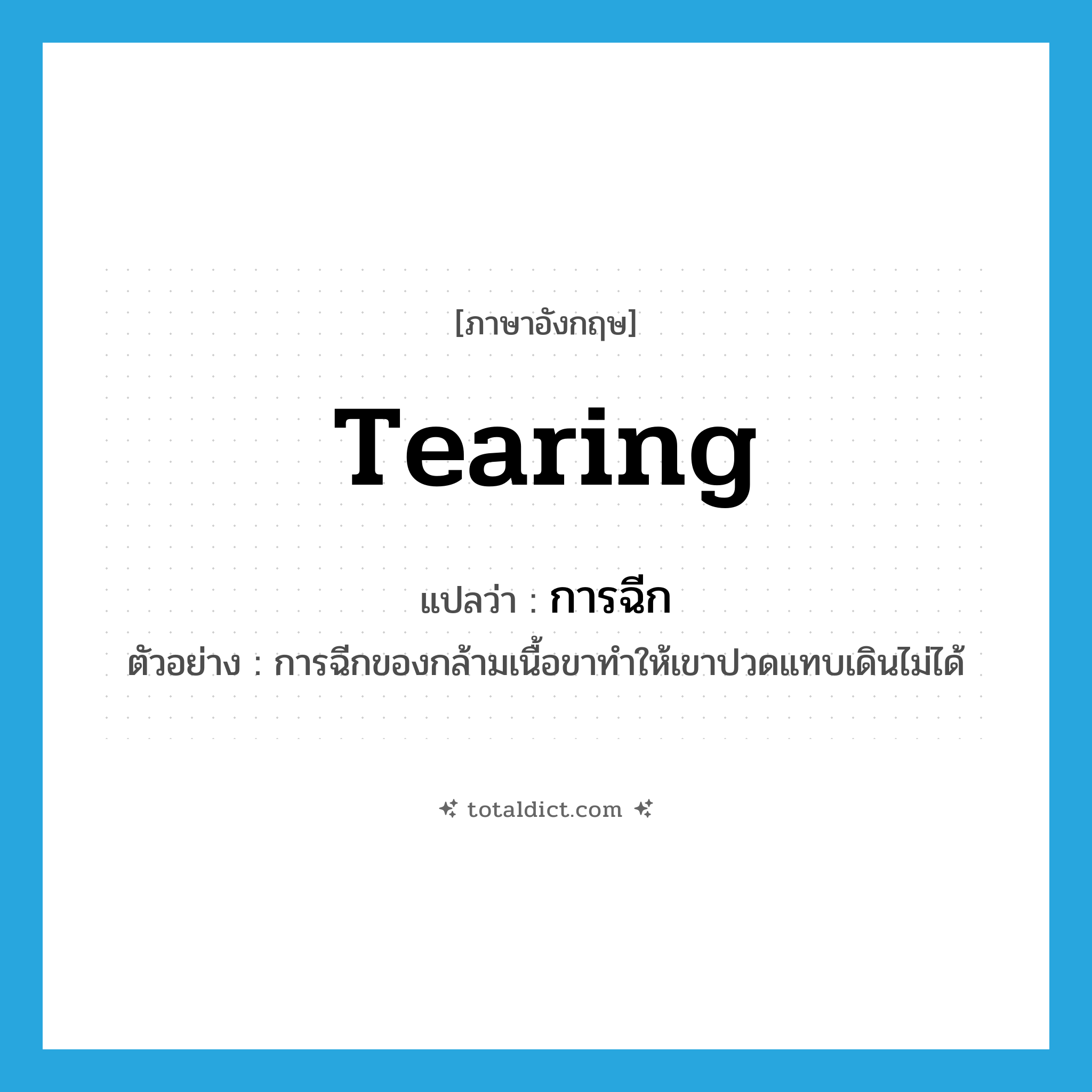 tearing แปลว่า?, คำศัพท์ภาษาอังกฤษ tearing แปลว่า การฉีก ประเภท N ตัวอย่าง การฉีกของกล้ามเนื้อขาทำให้เขาปวดแทบเดินไม่ได้ หมวด N