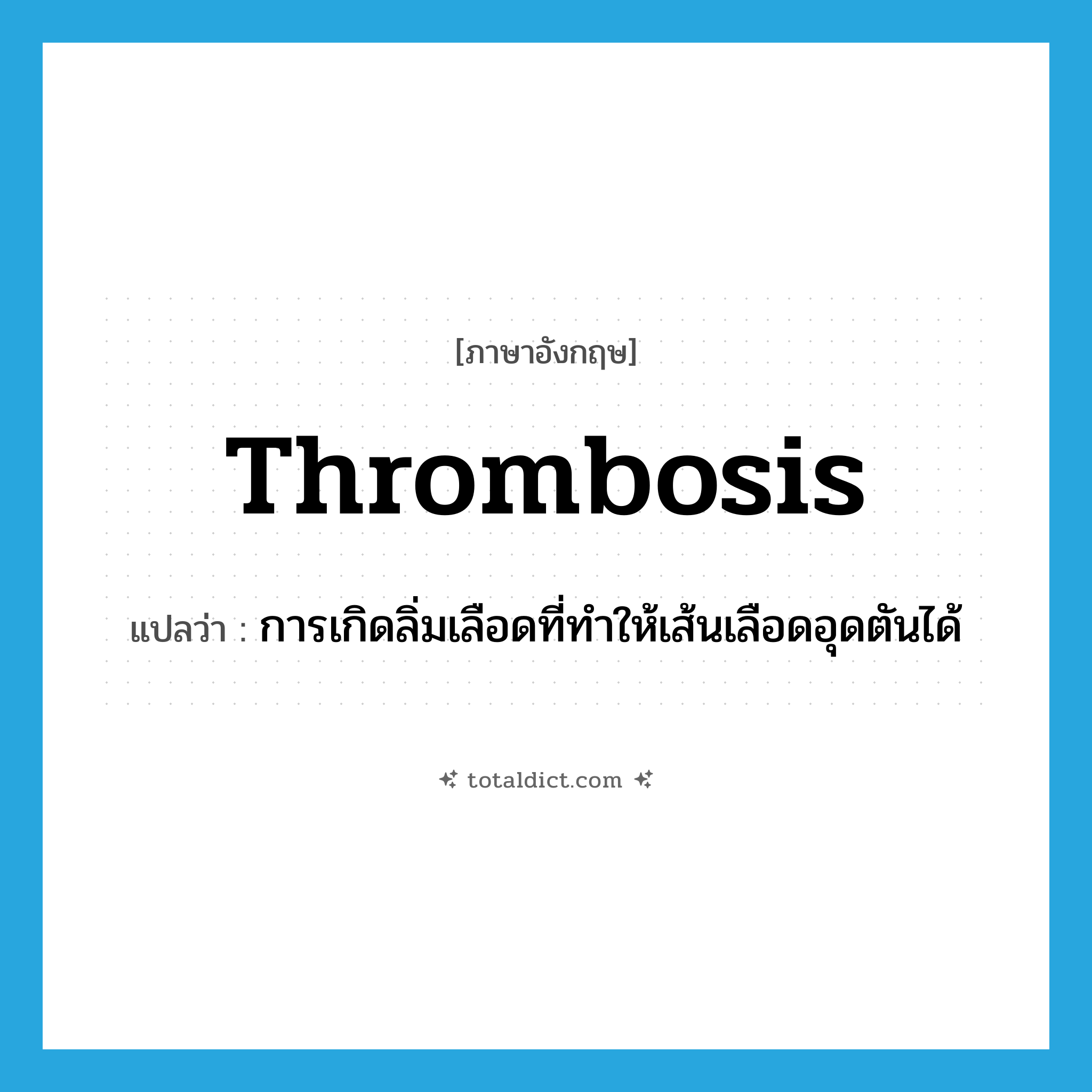 thrombosis แปลว่า?, คำศัพท์ภาษาอังกฤษ thrombosis แปลว่า การเกิดลิ่มเลือดที่ทำให้เส้นเลือดอุดตันได้ ประเภท N หมวด N