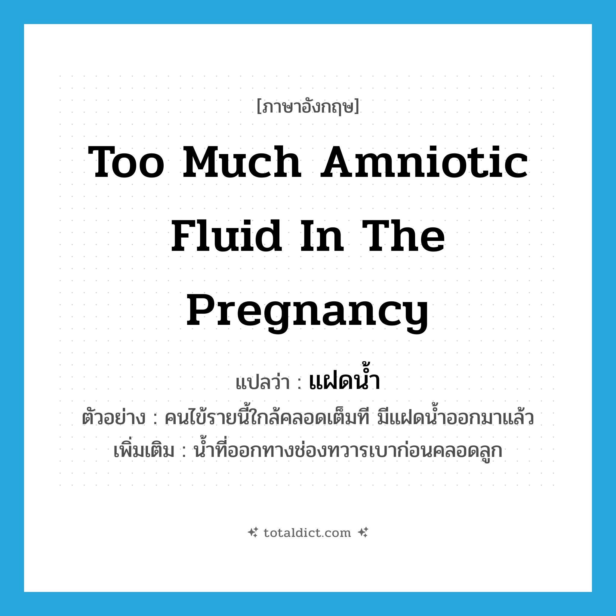 too much amniotic fluid in the pregnancy แปลว่า?, คำศัพท์ภาษาอังกฤษ too much amniotic fluid in the pregnancy แปลว่า แฝดน้ำ ประเภท N ตัวอย่าง คนไข้รายนี้ใกล้คลอดเต็มที มีแฝดน้ำออกมาแล้ว เพิ่มเติม น้ำที่ออกทางช่องทวารเบาก่อนคลอดลูก หมวด N