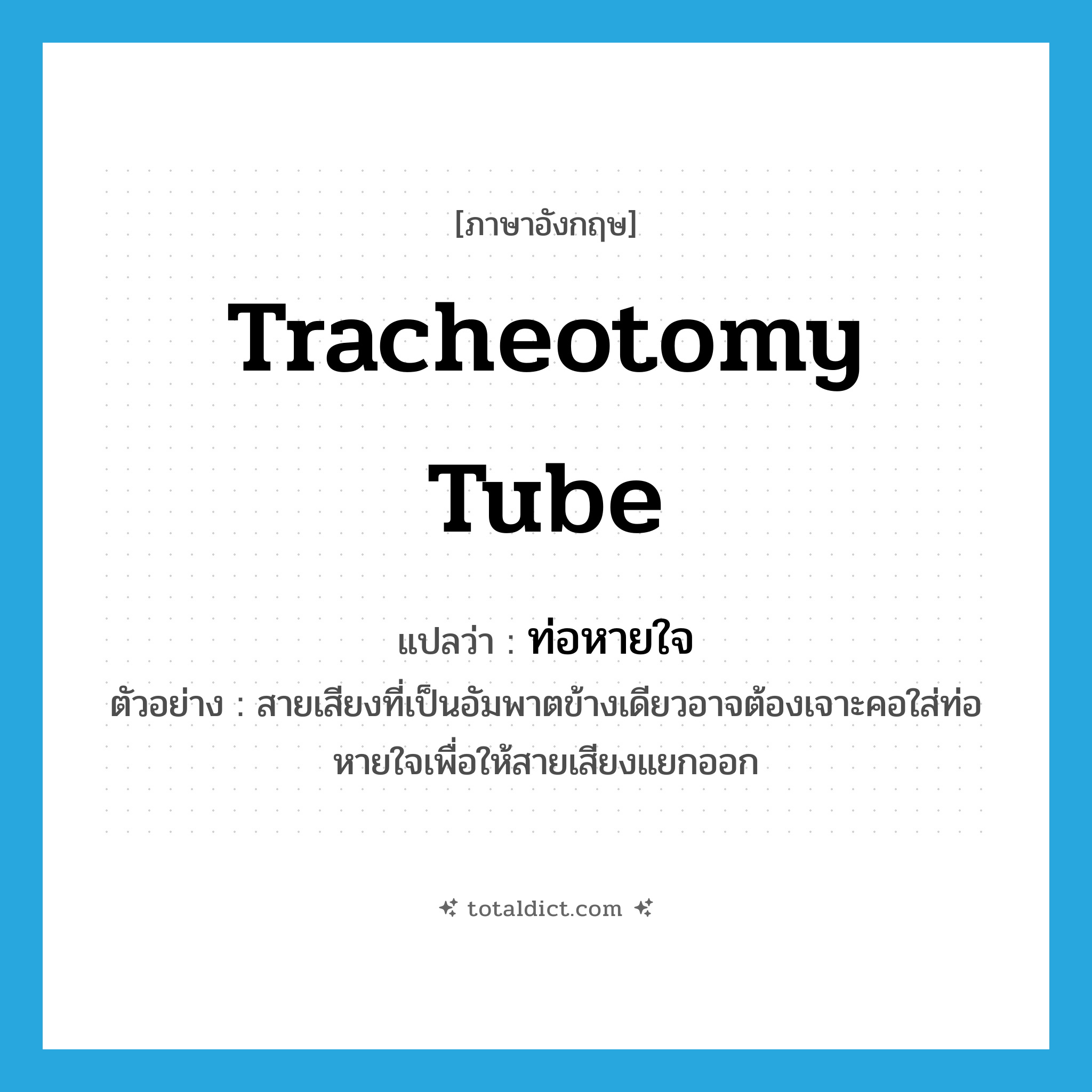 tracheotomy tube แปลว่า?, คำศัพท์ภาษาอังกฤษ tracheotomy tube แปลว่า ท่อหายใจ ประเภท N ตัวอย่าง สายเสียงที่เป็นอัมพาตข้างเดียวอาจต้องเจาะคอใส่ท่อหายใจเพื่อให้สายเสียงแยกออก หมวด N