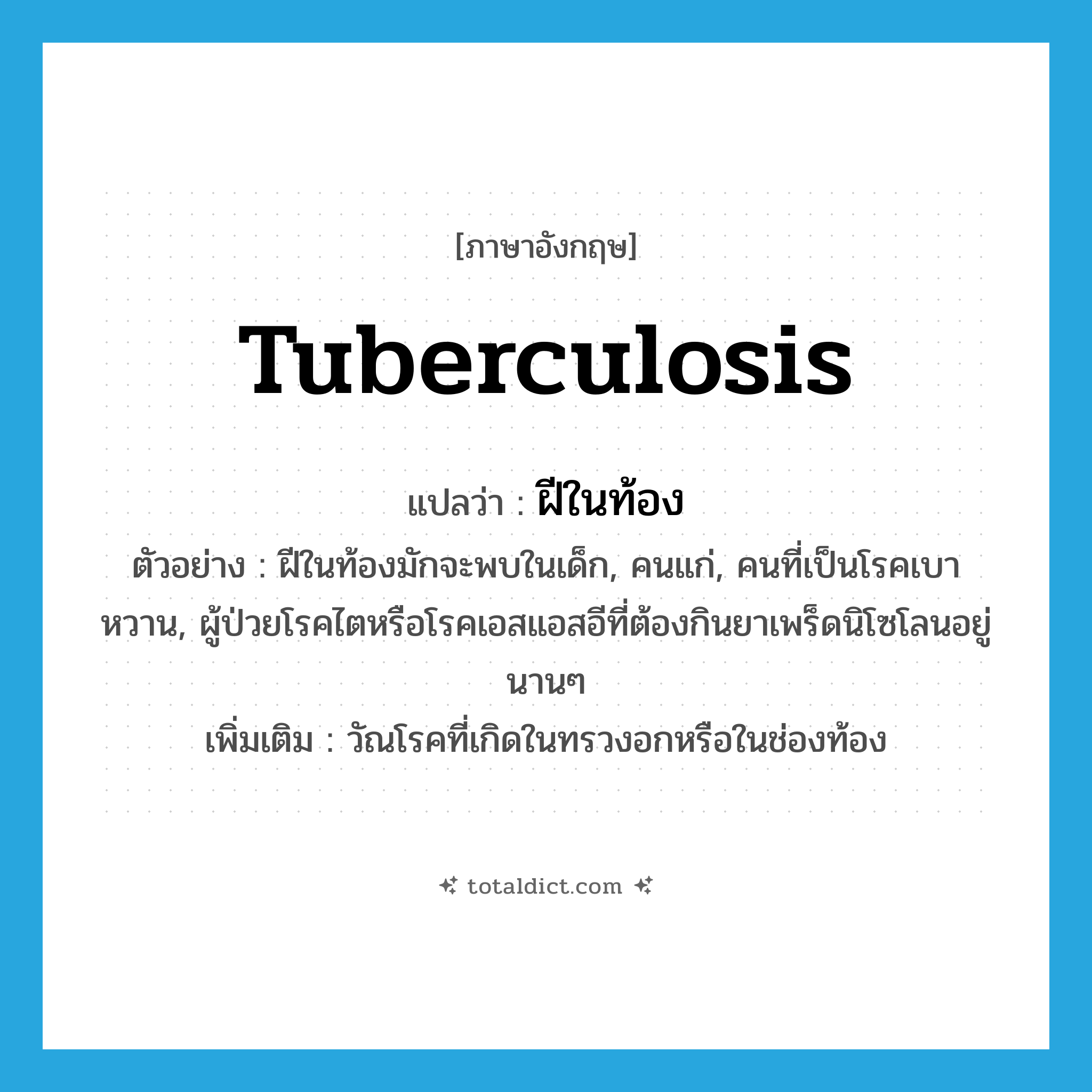 tuberculosis แปลว่า?, คำศัพท์ภาษาอังกฤษ tuberculosis แปลว่า ฝีในท้อง ประเภท N ตัวอย่าง ฝีในท้องมักจะพบในเด็ก, คนแก่, คนที่เป็นโรคเบาหวาน, ผู้ป่วยโรคไตหรือโรคเอสแอสอีที่ต้องกินยาเพร็ดนิโซโลนอยู่นานๆ เพิ่มเติม วัณโรคที่เกิดในทรวงอกหรือในช่องท้อง หมวด N