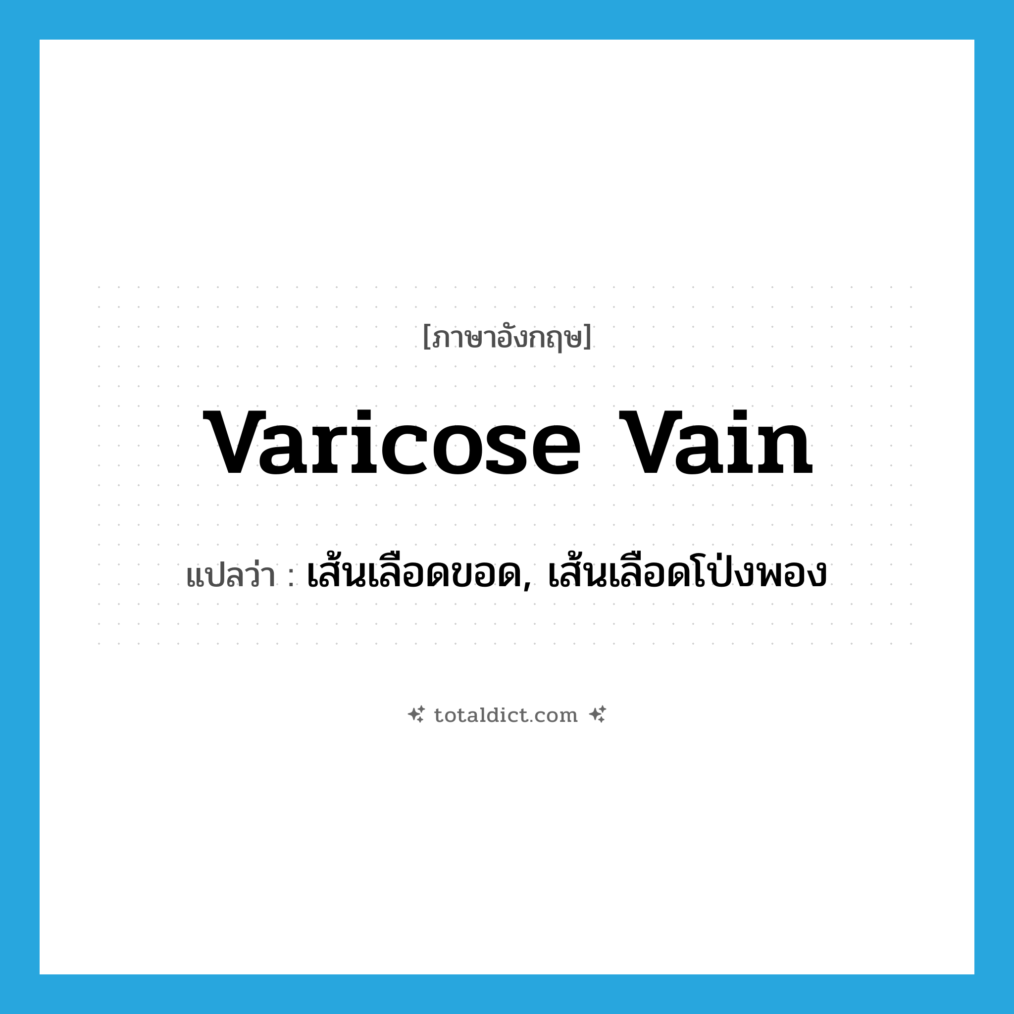 varicose vain แปลว่า?, คำศัพท์ภาษาอังกฤษ varicose vain แปลว่า เส้นเลือดขอด, เส้นเลือดโป่งพอง ประเภท N หมวด N