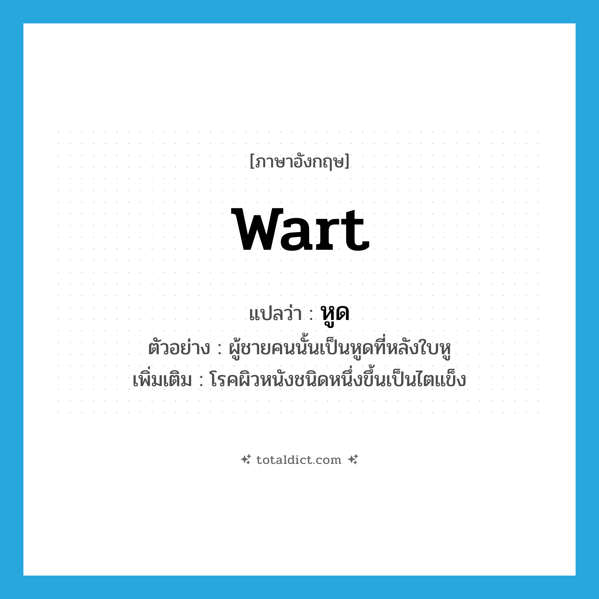 wart แปลว่า?, คำศัพท์ภาษาอังกฤษ wart แปลว่า หูด ประเภท N ตัวอย่าง ผู้ชายคนนั้นเป็นหูดที่หลังใบหู เพิ่มเติม โรคผิวหนังชนิดหนึ่งขึ้นเป็นไตแข็ง หมวด N